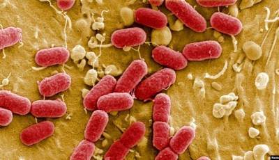 Bacterias resistentes a antibióticos