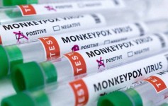 Perú reporta primera muerte relacionada a la viruela del mono