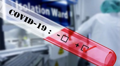 casos confirmados de COVID-19 en 31 condados de Minnesota