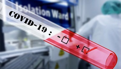 casos confirmados de COVID-19 en 31 condados de Minnesota
